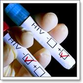 диагностика ВИЧ.jpg